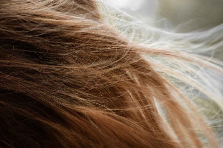 PCOS hair loss natural remedies explained by a pharmacist