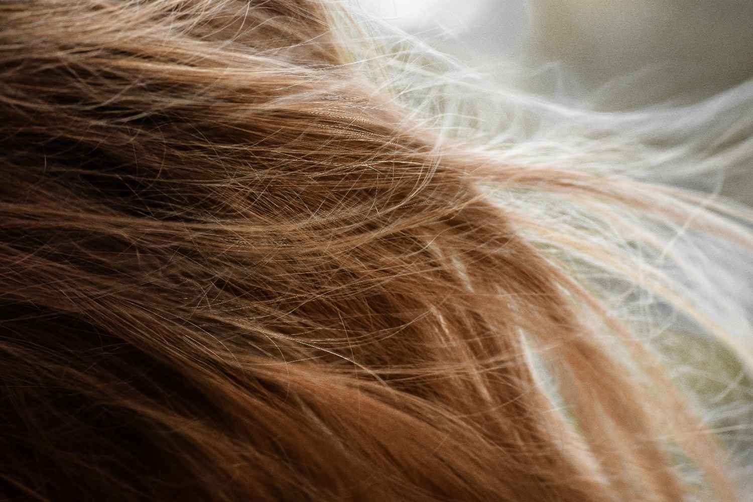 PCOS hair loss natural remedies explained by a pharmacist